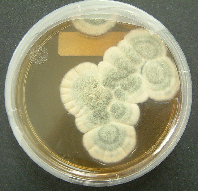 The Nobel – Alexander Fleming và Penicilline