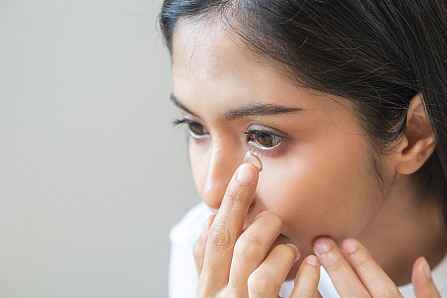 Tác dụng lâu dài của kính áp tròng làm chậm cận thị ở trẻ em